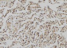 KIAA0191 / ZCCHC11 Antibody - 1:100 staining human lung tissue by IHC-P. The sample was formaldehyde fixed and a heat mediated antigen retrieval step in citrate buffer was performed. The sample was then blocked and incubated with the antibody for 1.5 hours at 22°C. An HRP conjugated goat anti-rabbit antibody was used as the secondary.