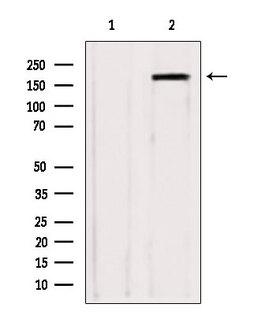 KIAA0191 / ZCCHC11 Antibody - Western blot analysis of extracts of various samples using ZCCHC11 antibody. Lane 1: HepG2 treated with blocking peptide. Lane 2: HepG2; Lane 3: B16F10;