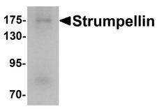 KIAA0196 Antibody - Western blot analysis of Strumpellin in human ovary tissue lysate with Strumpellin antibody at 1 ug/ml.