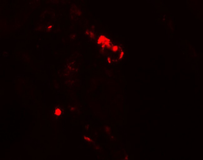 KIAA0226 / RUBICON Antibody - Immunofluorescence of RUBICON in human kidney tissue with RUBICON antibody at 20 ug/ml.