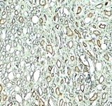 KIAA0226 / RUBICON Antibody - Immunohistochemistry of RUBICON in human kidney tissue with RUBICON antibody at 5 ug/ml.