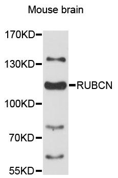 KIAA0226 / RUBICON Antibody - Western blot analysis of extracts of mouse brain, using RUBCN antibody at 1:3000 dilution. The secondary antibody used was an HRP Goat Anti-Rabbit IgG (H+L) at 1:10000 dilution. Lysates were loaded 25ug per lane and 3% nonfat dry milk in TBST was used for blocking. An ECL Kit was used for detection and the exposure time was 90s.