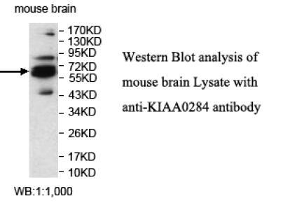 KIAA0284 Antibody