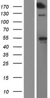 KIAA0284 Protein - Western validation with an anti-DDK antibody * L: Control HEK293 lysate R: Over-expression lysate