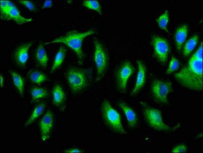 KIAA0319 Antibody - Immunofluorescence staining of A549 cells at a dilution of 1:166, counter-stained with DAPI. The cells were fixed in 4% formaldehyde, permeabilized using 0.2% Triton X-100 and blocked in 10% normal Goat Serum. The cells were then incubated with the antibody overnight at 4 °C.The secondary antibody was Alexa Fluor 488-congugated AffiniPure Goat Anti-Rabbit IgG (H+L) .