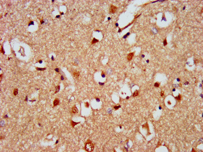 KIAA0319 Antibody - Immunohistochemistry image at a dilution of 1:500 and staining in paraffin-embedded human brain tissue performed on a Leica BondTM system. After dewaxing and hydration, antigen retrieval was mediated by high pressure in a citrate buffer (pH 6.0) . Section was blocked with 10% normal goat serum 30min at RT. Then primary antibody (1% BSA) was incubated at 4 °C overnight. The primary is detected by a biotinylated secondary antibody and visualized using an HRP conjugated SP system.