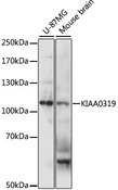 KIAA0319 Antibody - Western blot analysis of extracts of various cell lines, using KIAA0319 antibody at 1:1000 dilution. The secondary antibody used was an HRP Goat Anti-Rabbit IgG (H+L) at 1:10000 dilution. Lysates were loaded 25ug per lane and 3% nonfat dry milk in TBST was used for blocking. An ECL Kit was used for detection and the exposure time was 5s.