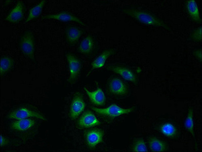 KIAA0319L Antibody - Immunofluorescent analysis of A549 cells using KIAA0319L Antibody at dilution of 1:100 and Alexa Fluor 488-congugated AffiniPure Goat Anti-Rabbit IgG(H+L)