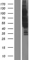 KIAA0355 Protein - Western validation with an anti-DDK antibody * L: Control HEK293 lysate R: Over-expression lysate