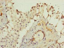 KIAA0391 Antibody - Immunohistochemistry of paraffin-embedded human testis tissue at dilution of 1:100