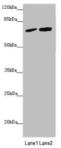 KIAA0391 Antibody - Western blot All Lanes:KIAA0391 antibody at 1.06 ug/ml Lane 1: LO2 whole cell lysate Lane 2: 293T whole cell lysate Secondary Goat polyclonal to rabbit IgG at 1/10000 dilution Predicted band size: 68,66,25,57 kDa Observed band size: 67 kDa