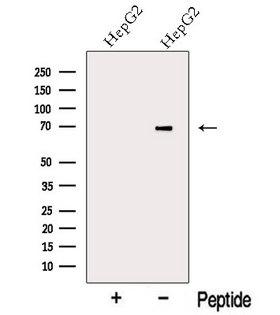 KIAA0391 Antibody - Western blot analysis of extracts of HepG2 cells using MRPP3 antibody. The lane on the left was treated with blocking peptide.