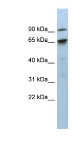 KIAA0427 / CTIF Antibody - CTIF / KIAA0427 antibody Western blot of Fetal Small Intestine lysate. This image was taken for the unconjugated form of this product. Other forms have not been tested.