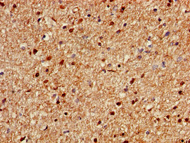 KIAA0467 / SZT2 Antibody - Immunohistochemistry of paraffin-embedded human brain tissue using SZT2 Antibody at dilution of 1:100