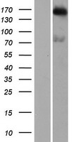 KIAA0476 / DENND4B Protein - Western validation with an anti-DDK antibody * L: Control HEK293 lysate R: Over-expression lysate