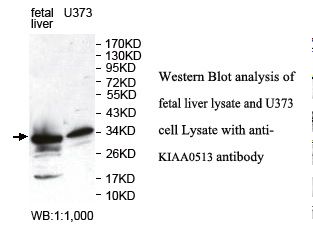 KIAA0513 Antibody