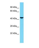 KIAA0513 Antibody - Western blot of KIAA0513 Antibody - C-terminal region with human OVCAR-3 cells lysate.  This image was taken for the unconjugated form of this product. Other forms have not been tested.