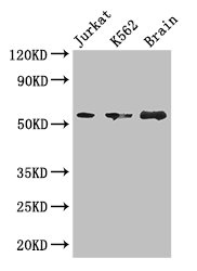 KIAA0513 Antibody - Western Blot Positive WB detected in: Jurkat whole cell lysate, K562 whole cell lysate, Mouse brain tissue All lanes: ACVRL1 antibody at 2.7µg/ml Secondary Goat polyclonal to rabbit IgG at 1/50000 dilution Predicted band size: 47, 34, 46 kDa Observed band size: 57 kDa