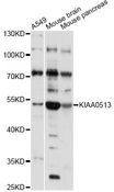 KIAA0513 Antibody - Western blot analysis of extracts of various cell lines, using KIAA0513 antibody at 1:1000 dilution. The secondary antibody used was an HRP Goat Anti-Rabbit IgG (H+L) at 1:10000 dilution. Lysates were loaded 25ug per lane and 3% nonfat dry milk in TBST was used for blocking. An ECL Kit was used for detection and the exposure time was 1s.