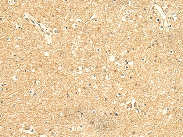 KIAA0513 Antibody - Immunohistochemistry of paraffin-embedded Human brain tissue  using KIAA0513 Polyclonal Antibody at dilution of 1:50(×200)