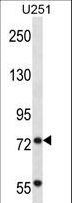 KIAA0517 / TRIM2 Antibody - TRIM2 Antibody western blot of U251 cell line lysates (35 ug/lane). The TRIM2 antibody detected the TRIM2 protein (arrow).