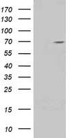 KIAA0517 / TRIM2 Antibody - HEK293T cells were transfected with the pCMV6-ENTRY control (Left lane) or pCMV6-ENTRY TRIM2 (Right lane) cDNA for 48 hrs and lysed. Equivalent amounts of cell lysates (5 ug per lane) were separated by SDS-PAGE and immunoblotted with anti-TRIM2.