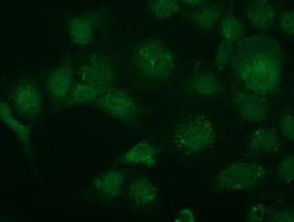 KIAA0517 / TRIM2 Antibody - Anti-TRIM2 mouse monoclonal antibody immunofluorescent staining of COS7 cells transiently transfected by pCMV6-ENTRY TRIM2.
