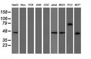 KIAA0517 / TRIM2 Antibody - Western blot of extracts (35 ug) from 9 different cell lines by using anti-TRIM2 monoclonal antibody.