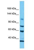 KIAA0528 Antibody - KIAA0528 antibody Western Blot of 721_B. Antibody dilution: 1 ug/ml.  This image was taken for the unconjugated form of this product. Other forms have not been tested.