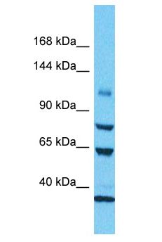 KIAA0528 Antibody - KIAA0528 antibody Western Blot of 721_B. Antibody dilution: 1 ug/ml.  This image was taken for the unconjugated form of this product. Other forms have not been tested.