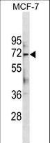 KIAA0652 / ATG13 Antibody - ATG13 Antibody (Center S355.) western blot of MCF-7 cell line lysates (35 ug/lane). The ATG13 antibody detected the ATG13 protein (arrow).