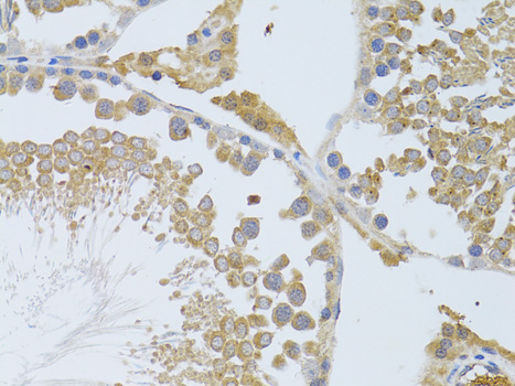 KIAA0652 / ATG13 Antibody - Immunohistochemistry of paraffin-embedded rat testis using ATG13 antibodyat dilution of 1:100 (40x lens).