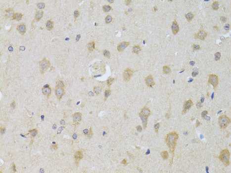 KIAA0652 / ATG13 Antibody - Immunohistochemistry of paraffin-embedded rat brain using ATG13 antibodyat dilution of 1:100 (40x lens).