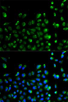 KIAA0652 / ATG13 Antibody - Immunofluorescence analysis of A549 cells using ATG13 antibody. Blue: DAPI for nuclear staining.