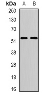 KIAA0652 / ATG13 Antibody - Western blot analysis of ATG13 expression in T47D (A); SW480 (B) whole cell lysates.