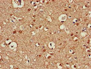 KIAA0652 / ATG13 Antibody - Immunohistochemistry of paraffin-embedded human brain tissue at dilution of 1:100