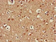 KIAA0652 / ATG13 Antibody - Immunohistochemistry of paraffin-embedded human brain tissue at dilution of 1:100