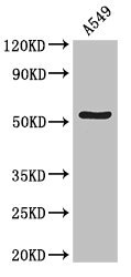 KIAA0652 / ATG13 Antibody - Western Blot Positive WB detected in:A549 whole cell lysate All Lanes:ATG13 antibody at 4µg/ml Secondary Goat polyclonal to rabbit IgG at 1/50000 dilution Predicted band size: 57,53,45,61 KDa Observed band size: 57 KDa