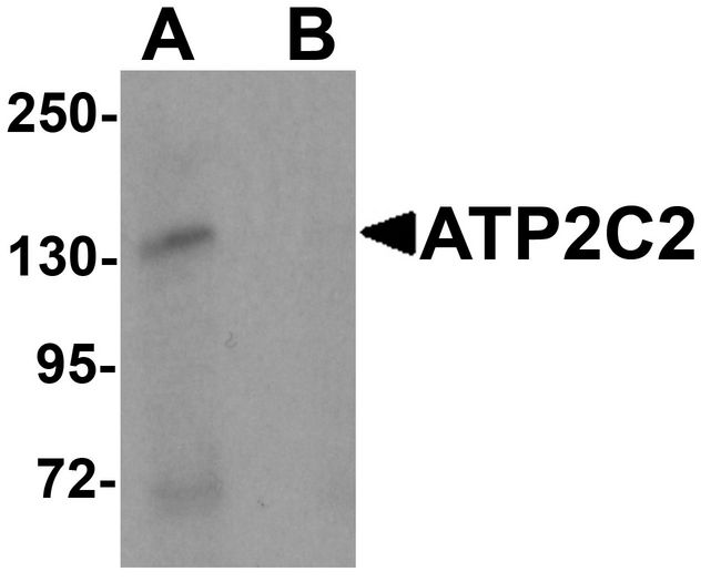 KIAA0703 / SPCA2 Antibody - Western blot analysis of ATP2C2 in 3T3 cell lysate with ATP2C2 antibody at 1 ug/ml in (A) the absence and (B) the presence of blocking peptide.