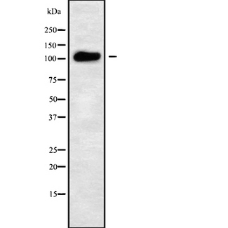 KIAA0703 / SPCA2 Antibody - Western blot analysis of ATP2C2 using LOVO cells whole cells lysates