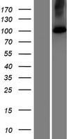 KIAA0703 / SPCA2 Protein - Western validation with an anti-DDK antibody * L: Control HEK293 lysate R: Over-expression lysate