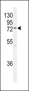 KIAA0776 / NLBP Antibody - Western blot of K0776 Antibody in MCF-7 cell line lysates (35 ug/lane). K0776 (arrow) was detected using the purified antibody.
