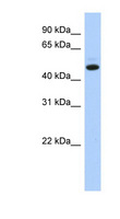 KIAA0825 Antibody - KIAA0825 / C5orf36 antibody Western blot of HeLa lysate. This image was taken for the unconjugated form of this product. Other forms have not been tested.