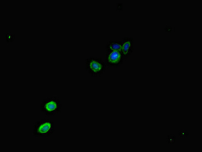 KIAA0833 / CAMTA1 Antibody - Immunofluorescent analysis of HepG2 cells diluted at 1:100 and Alexa Fluor 488-congugated AffiniPure Goat Anti-Rabbit IgG(H+L)