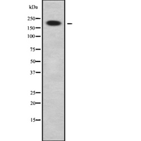 KIAA0833 / CAMTA1 Antibody - Western blot analysis of CAMTA1 using K562 whole cells lysates