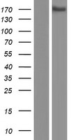 KIAA0922 Protein - Western validation with an anti-DDK antibody * L: Control HEK293 lysate R: Over-expression lysate