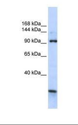 KIAA1024 Antibody - Fetal brain lysate. Antibody concentration: 1.0 ug/ml. Gel concentration: 6-18%.  This image was taken for the unconjugated form of this product. Other forms have not been tested.