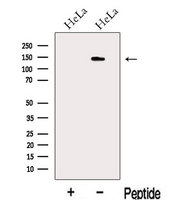 KIAA1033 Antibody - Western blot analysis of extracts of HeLa cells using KIAA1033 antibody. The lane on the left was treated with blocking peptide.