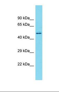 KIAA1045 Antibody - Western blot of U937. KIAA1429 antibody dilution 1.0 ug/ml.  This image was taken for the unconjugated form of this product. Other forms have not been tested.