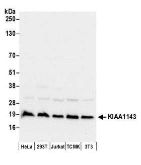 KIAA1143 Antibody - Detection of human and mouse KIAA1143 by western blot. Samples: Whole cell lysate (50 µg) from HeLa, HEK293T, Jurkat, mouse TCMK-1, and mouse NIH 3T3 cells prepared using NETN lysis buffer. Antibodies: Affinity purified rabbit anti-KIAA1143 antibody used for WB at 0.04 µg/ml. Detection: Chemiluminescence with an exposure time of 10 seconds.